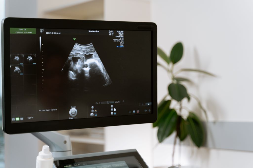 pregnancy scans and tests available in malta