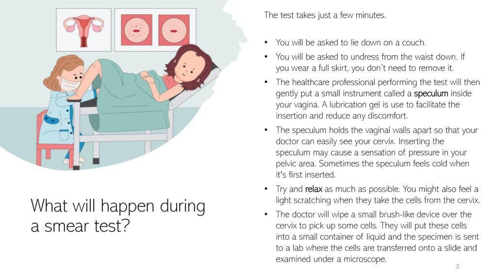 cervical screening