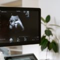 pregnancy scans and tests available in malta